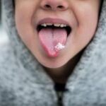 Jak rozpoznać grzybicę jamy ustnej? Warto wiedzieć o jej objawach!