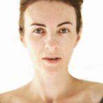 Czy laserowe zabiegi na worki pod oczami są bezpieczne dla delikatnej skóry?